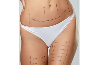 Liposuction By Bella Face and Body